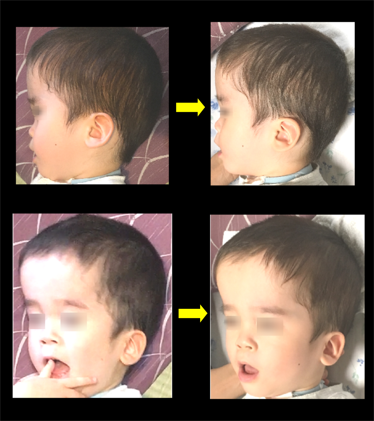 頭　大きい　赤ちゃん