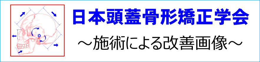 頭　大きい　赤ちゃん